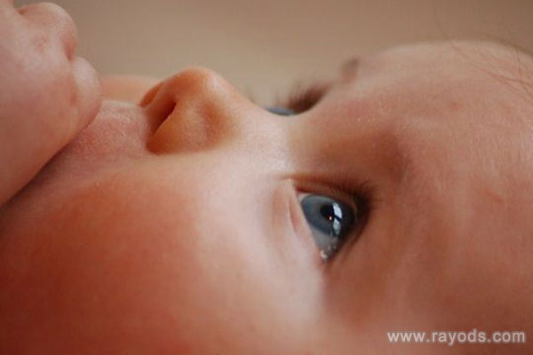 婴儿对眼多久恢复正常？婴儿对眼最佳治疗时