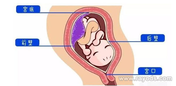 胎盘前壁和后壁在个方面存在不同